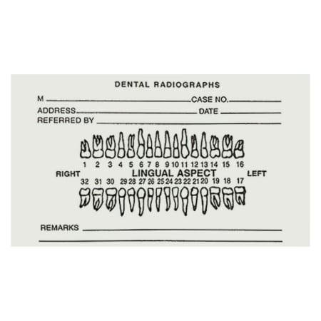 Henry Schein Dental X-Ray Envelopes