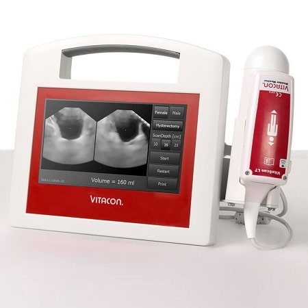 VitaScan PD Ultrasound Bladder Scanner